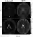 Fig. 09 - Complex-valued neural network with learnable non-linearities in medical imaging