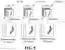 Fig. 05 - Radiographic imaging apparatus
