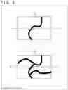 Fig. 09 - Medical image processing apparatus, medical image processing method, and program