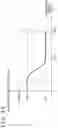Fig. 16 - Medical image processing apparatus, medical image processing method, and program