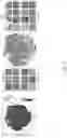 Fig. 33 - Systems and methods for multiple instance learning for classification and localization in biomedical imaging