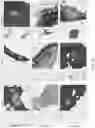 Fig. 35 - Systems and methods for multiple instance learning for classification and localization in biomedical imaging
