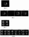 Fig. 06 - Auto comparison layout based on image similarity