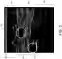 Fig. 04 - Ultrasonic diagnostic apparatus and ultrasonic image processing method
