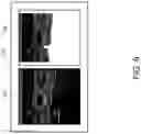 Fig. 10 - Ultrasonic diagnostic apparatus and ultrasonic image processing method