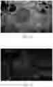 Fig. 03 - Pseudo H and E image producing method and optical system using same