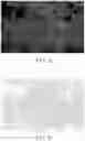 Fig. 05 - Pseudo H and E image producing method and optical system using same