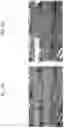 Fig. 15 - Image processing apparatus, imaging apparatus, image processing method, and program