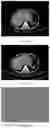 Fig. 17 - System and method for image reconstruction