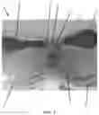 Fig. 04 - TRAINING MODEL FOR MEDICAL APPLICATIONS