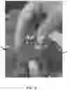 Fig. 07 - TRAINING MODEL FOR MEDICAL APPLICATIONS