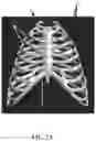 Fig. 08 - TRAINING MODEL FOR MEDICAL APPLICATIONS