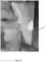 Fig. 11 - TRAINING MODEL FOR MEDICAL APPLICATIONS
