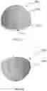 Fig. 05 - THIN FILM-BASED SPHERICAL OR HEMISPHERICAL DISPLAY DEVICE