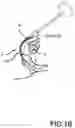 Fig. 04 - Pedal apparatus for percussion instrument