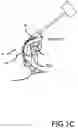 Fig. 05 - Pedal apparatus for percussion instrument