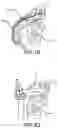 Fig. 06 - Pedal apparatus for percussion instrument