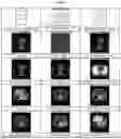 Fig. 06 - Image analysis method for multicenter study and system thereof