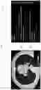 Fig. 08 - Systems and methods for improved analysis and generation of medical imaging reports