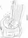 Fig. 02 - Fast sliding window delivery via a high-speed multileaf collimator