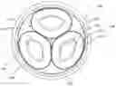Fig. 01 - High voltage three-phase cable
