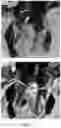 Fig. 13 - Supercapacitor of N—P doping porous graphene material in ionic liquid electrolyte and method for preparing thereof