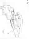 Fig. 04 - Clamp for a wire of an overhead line and method for tightening a wire of an overhead line