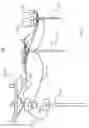 Fig. 03 - Downed conductor detection