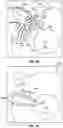 Fig. 14 - Electric machine winding assembly