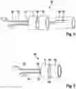 Fig. 04 - ROTOR OF AN ELECTRIC MACHINE, IN PARTICULAR OF A CLAW POLE MACHINE