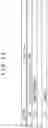 Fig. 13 - Transmission device, transmission method, reception device, and reception method