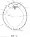 Fig. 16 - Playground apparatus comprising a camera support