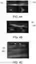 Fig. 07 - Projection device, projection system and an image calibration method