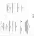 Fig. 29 - Surface normal vector processing mechanism