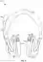 Fig. 03 - Eyewear accommodating headset with audio compensation