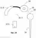 Fig. 15 - Cochlear stimulation system with an improved method for determining a temporal fine structure parameter