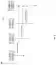Fig. 09 - Distributed multi-HNG son