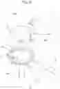 Fig. 09 - HEAD FOR A HEDGE TRIMMER