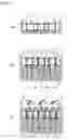 Fig. 03 - TREEFALL PREVENTION TOOL AND TREEFALL PREVENTING METHOD