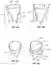 Fig. 10 - METHODS AND DEVICES FOR STIMULATING GROWTH OF GRAPE VINES, GRAPE VINE REPLANTS OR AGRICULTURAL CROPS
