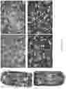 Fig. 04 - Method of cryopreservation of stem cell-derived retinal pigment epithelial cells on polymeric substrate