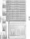 Fig. 13 - Reduced-coverage back-smoothing brassiere