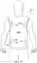 Fig. 12 - Medical apparatus