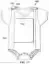 Fig. 17 - Medical apparatus