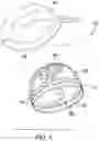 Fig. 02 - Absorptive Cap Liner