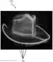 Fig. 01 - LIGHTED TRANSLUCENT HAT