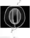Fig. 08 - LIGHTED TRANSLUCENT HAT