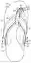 Fig. 01 - SANDALS CUSTOMIZED FOR A WEARER'S FEET AND METHOD OF MANUFACTURING SAME