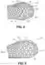 Fig. 09 - Method of customizing a sole structure of an article of footwear