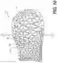 Fig. 10 - Method of customizing a sole structure of an article of footwear